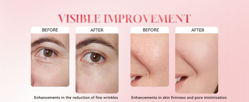 Before & After