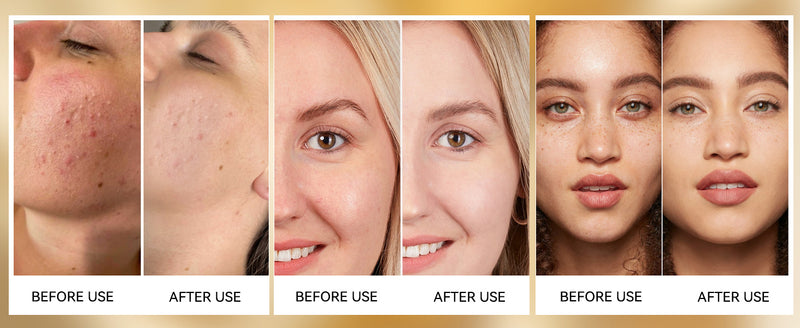Before & After