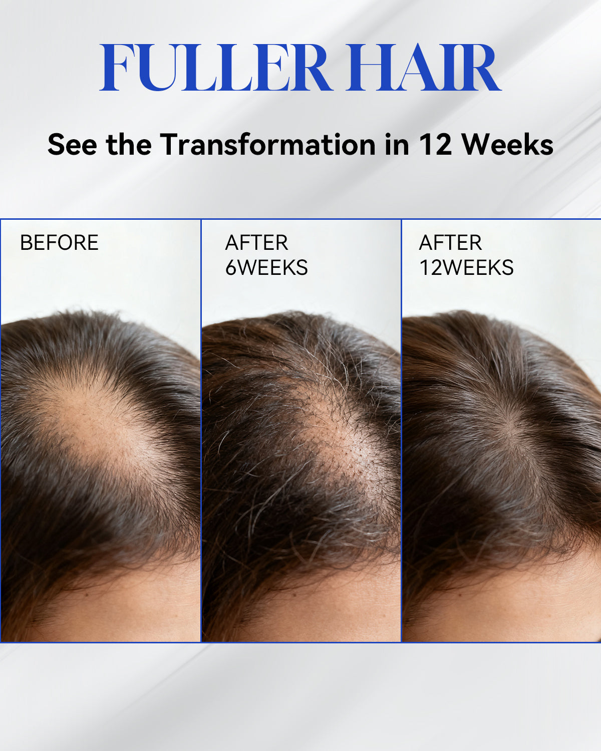 Hair Growth Serum for thicker and fuller hair