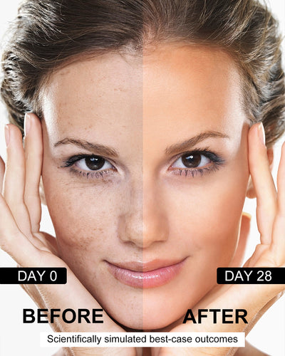 TJE Dark Spot Remover Serum