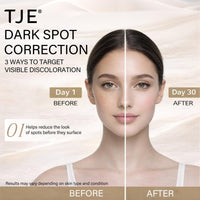 Dark Spot Remover for Face and Body, Dark Spot Corrector Cream with Niacinamide, 1.76 Oz, for Uneven Skin Tone, Sun Spots and Age Spots